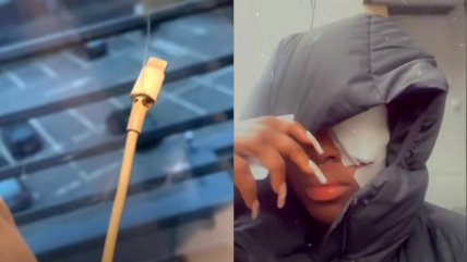   Cargador de celular explotó y chispa dejó parcialmente ciega a joven 