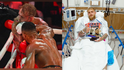   Jake Paul sufrió doble fractura de mandíbula en su derrota con Anthony Joshua 