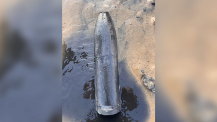   Joven llegó al hospital con un proyectil de la I Guerra Mundial en el recto 