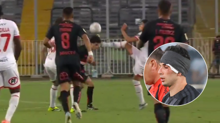  [VIDEO] La dura patada en la cara a Pastrán en la “Noche Alba” entre Colo Colo y Unión Española 