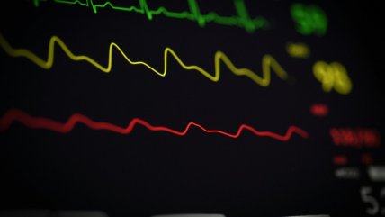   Infarto silencioso: las señales de alerta que no hay que ignorar 