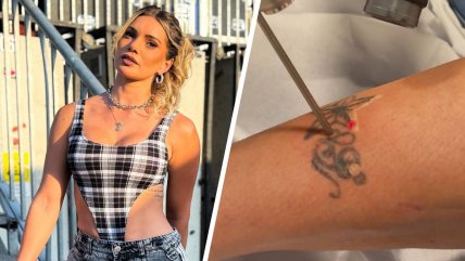  Faloon inició tratamiento para borrar sus tatuajes  